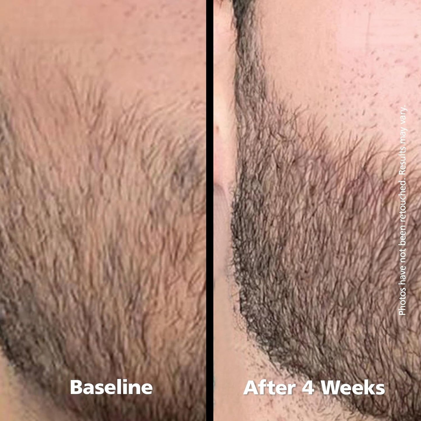 DABALASH Men | Suero Profesional para Vello Facial, Pestañas y Cejas | Con Aceite de Ricino, Pantenol & Aloe | Apariencia de vello más largo, denso y fuerte | 0.18 oz