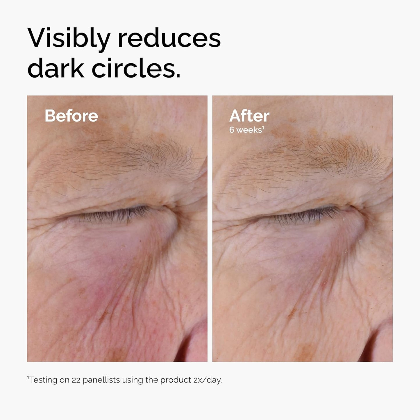 The Ordinary Caffeine Solution 5% + EGCG | Suero para Ojeras y Bolsas – Reduce Hinchazón y Signos de Cansancio – 30 ml