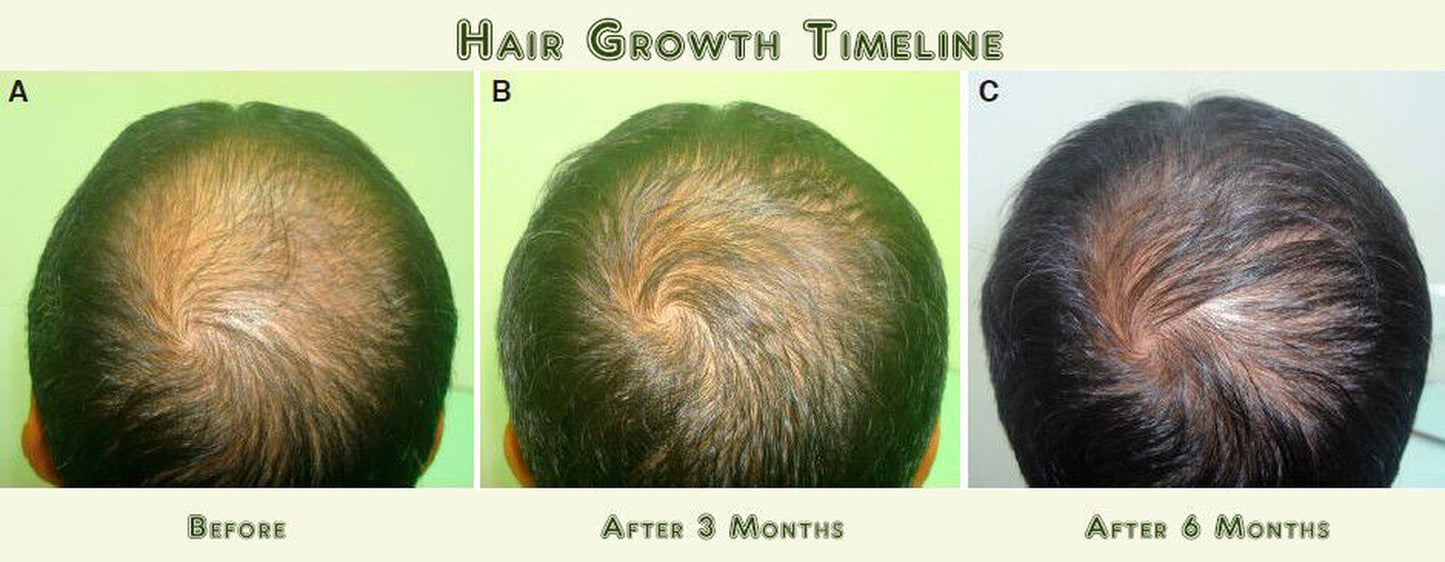 DAROXIL-16 Champú y Acondicionador Anticaída – Regeneración Total del Cabello