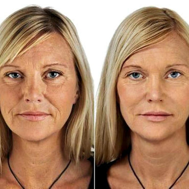 Crema Antiarrugas Retinol + Colágeno con Ácido Hialurónico, Vitaminas C y E – 118 ml