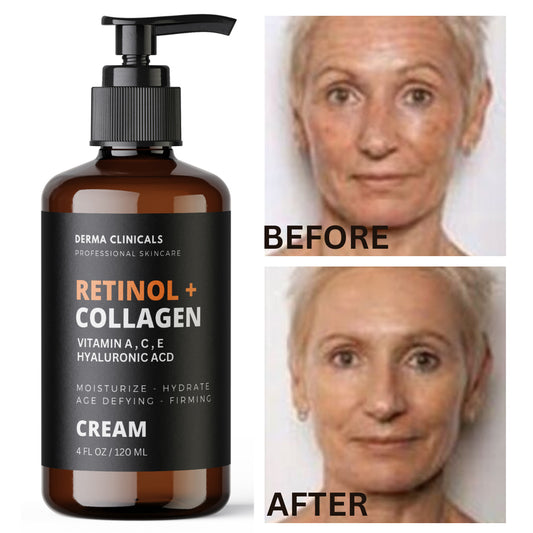 Crema Antiarrugas Retinol + Colágeno con Ácido Hialurónico, Vitaminas C y E – 118 ml