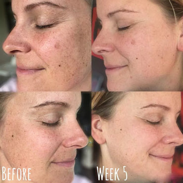 Dark Skin Ultra Whitening Gel Cream - Blanqueamiento de Piel