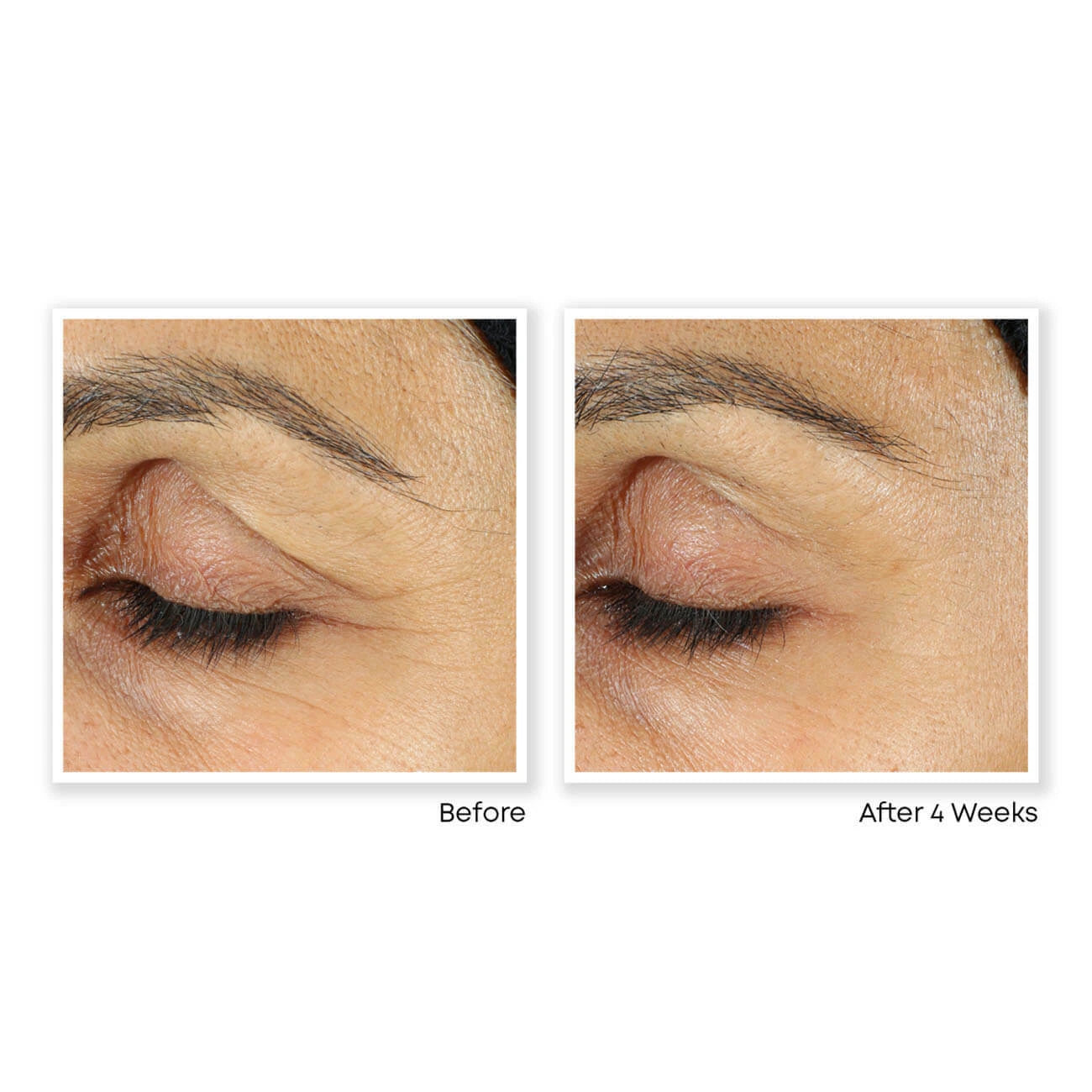 PURE RETINOL VITAMIN A 2.5% + ÁCIDO HIALURÓNICO – Crema/Serum Antiarrugas de Alta Potencia