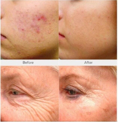 Crema Antiarrugas Retinol + Colágeno con Ácido Hialurónico, Vitaminas C y E – 118 ml
