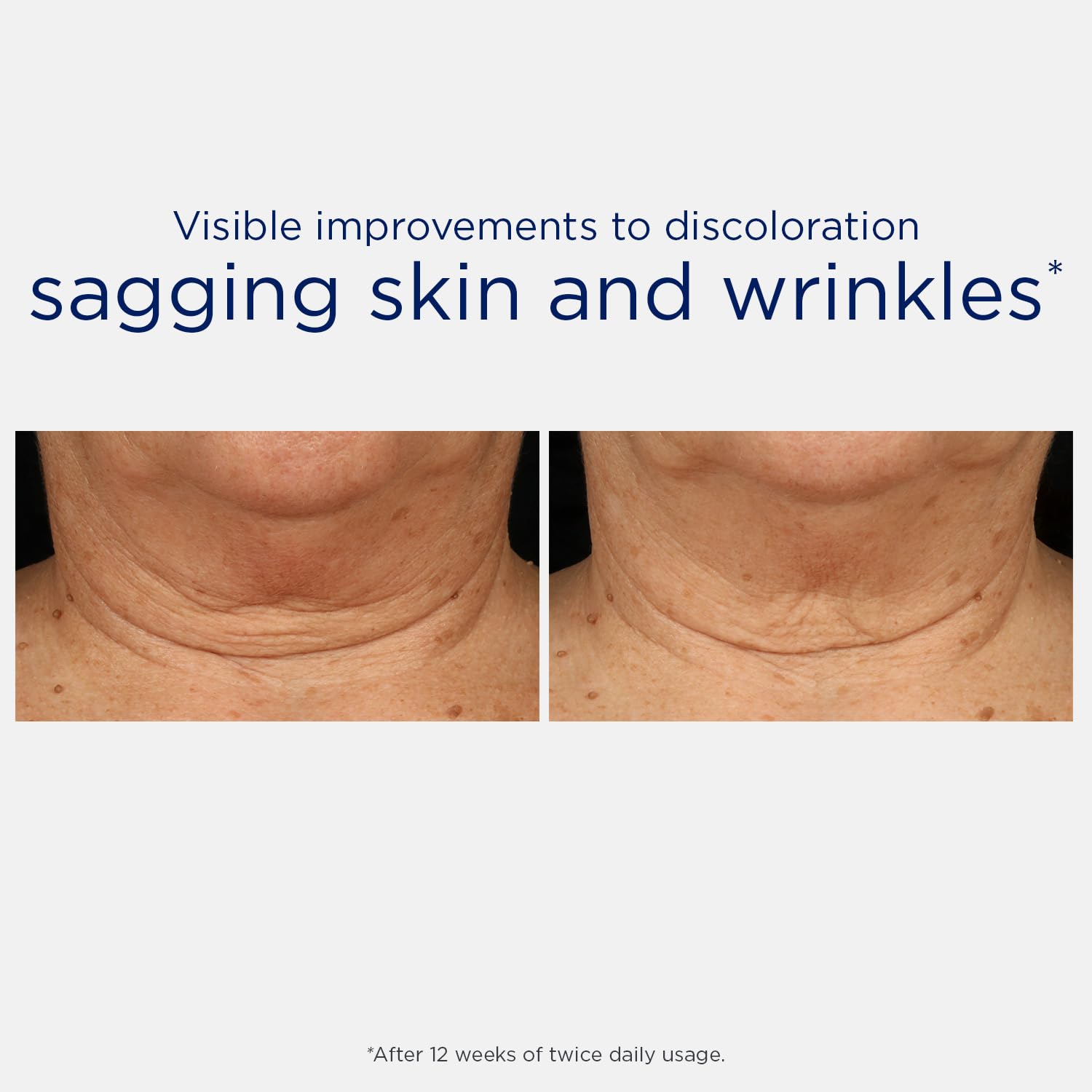 Skin Active Triple Firming Neck Cream | Hidratante Antiedad con Microdipeptide229 | Reafirma, Alisa Arrugas y Mejora la Elasticidad en Cuello & Escote | Sin Fragancia | Todo Tipo de Piel | 80 g