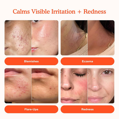 SOS diario - Spray facial para pieles sensibles - Ac hipocloroso - Reducción de enrojecimiento