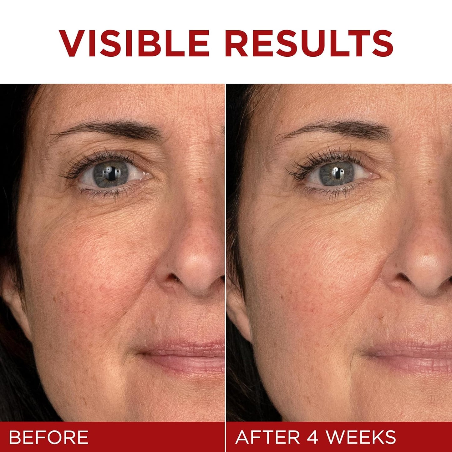 L’Oréal Paris Revitalift Triple Power | Hidratante Anti-Edad con Pro-Retinol, Ácido Hialurónico y Vitamina C