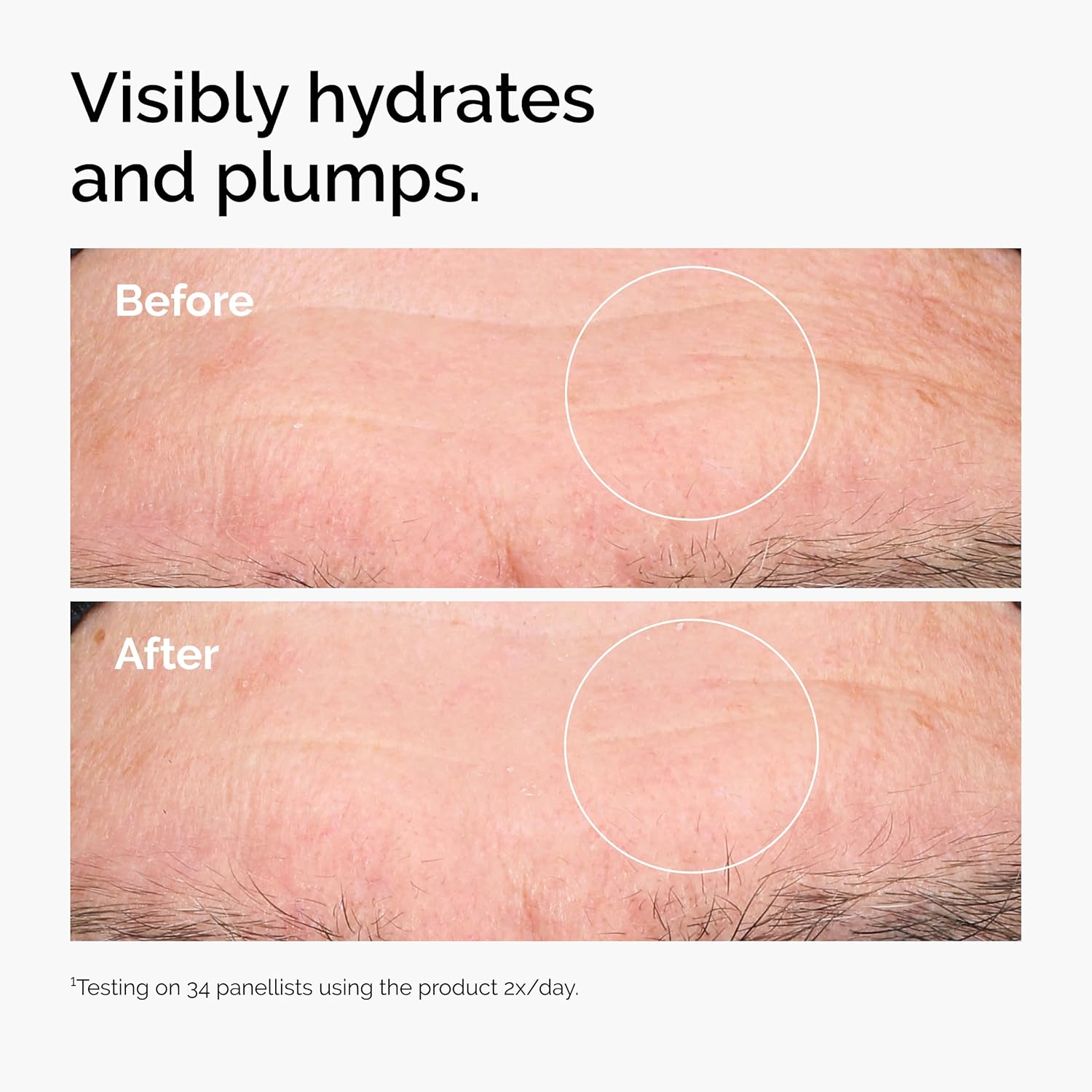 The Ordinary Hyaluronic Acid 2% + B5 con Ceramidas | Sérum Facial Hidratante Multi-Capas – Antiarrugas, Reafirmante y Reparador de la Barrera Cutánea – 30 ml