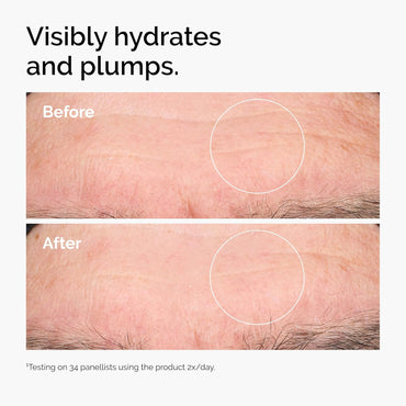 The Ordinary Hyaluronic Acid 2% + B5 con Ceramidas | Sérum Facial Hidratante Multi-Capas – Antiarrugas, Reafirmante y Reparador de la Barrera Cutánea – 30 ml