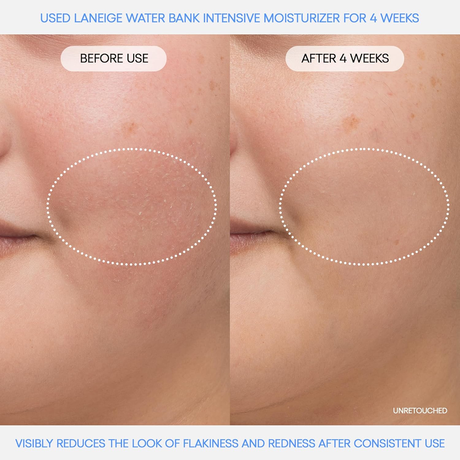 LANEIGE Crema hidratante de agua con Acido hialurónico intensivo con Peptidos + Escualano: piel propensa al eczema, refuerzo de barreras, nutrición, sequedad