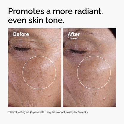 The Ordinary Glycolic Acid 7% Exfoliating Toner | Tónico Exfoliante Diario – Piel Más Luminosa, Suave y Tonificada – 240 ml