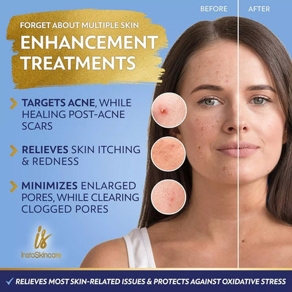 Serum Niacinamida 10% para Rostro con Zinc 1% y Vit B3 (8 Oz) — Iluminador y Antienvejecimiento