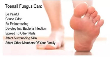 FungusCure RX - Tratamiento Hongos de Uñas