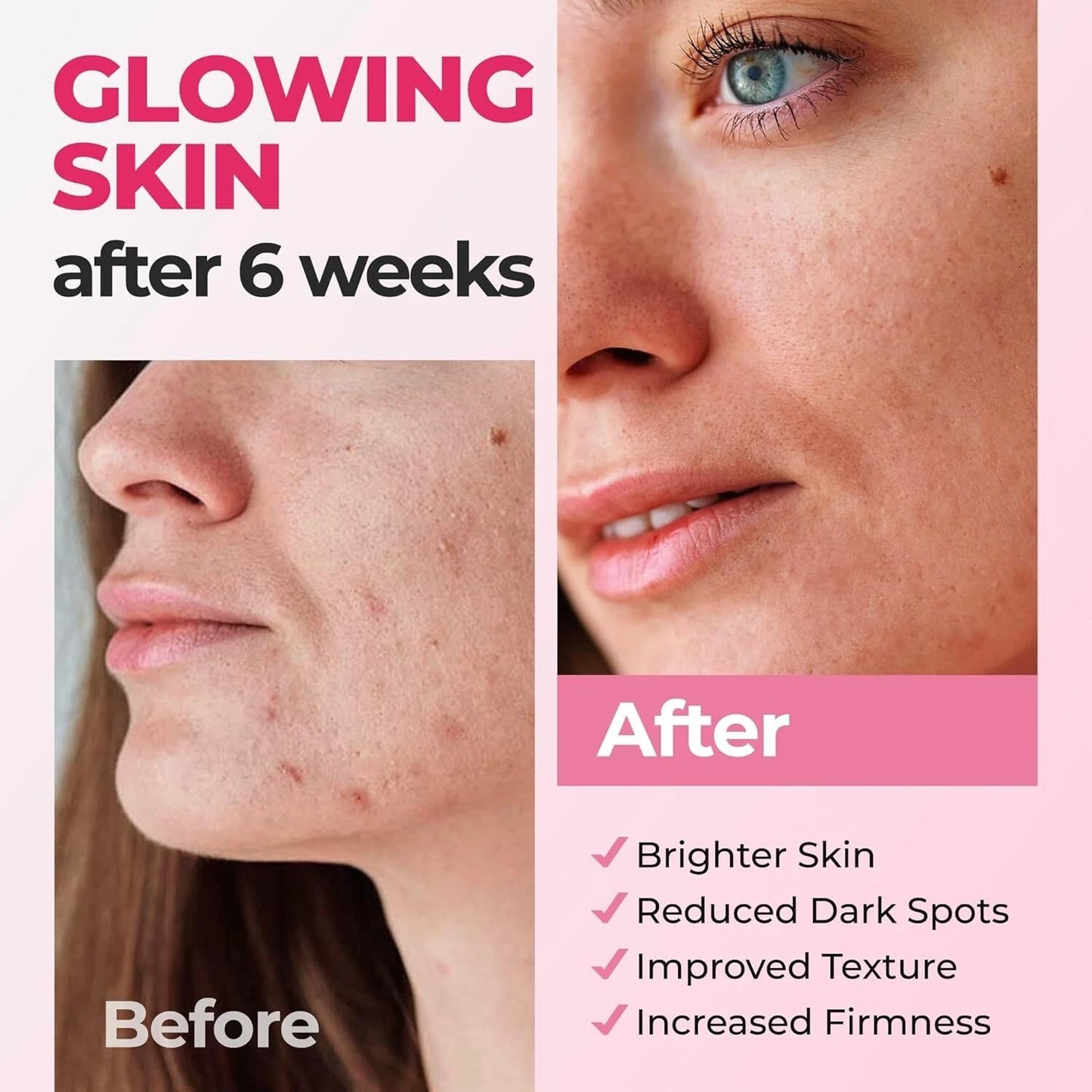 Serum Facial y Contorno de Ojos con Vitamina C, Ácido Hialurónico y Vitamina E – 30 ml