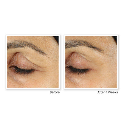 PURE RETINOL VITAMIN A 2.5% + ÁCIDO HIALURÓNICO – Crema/Serum Antiarrugas de Alta Potencia